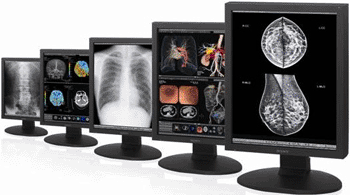 Image: The LMD-DM series of high-luminance, high-contrast medical displays (Photo courtesy of Sony Electronics).